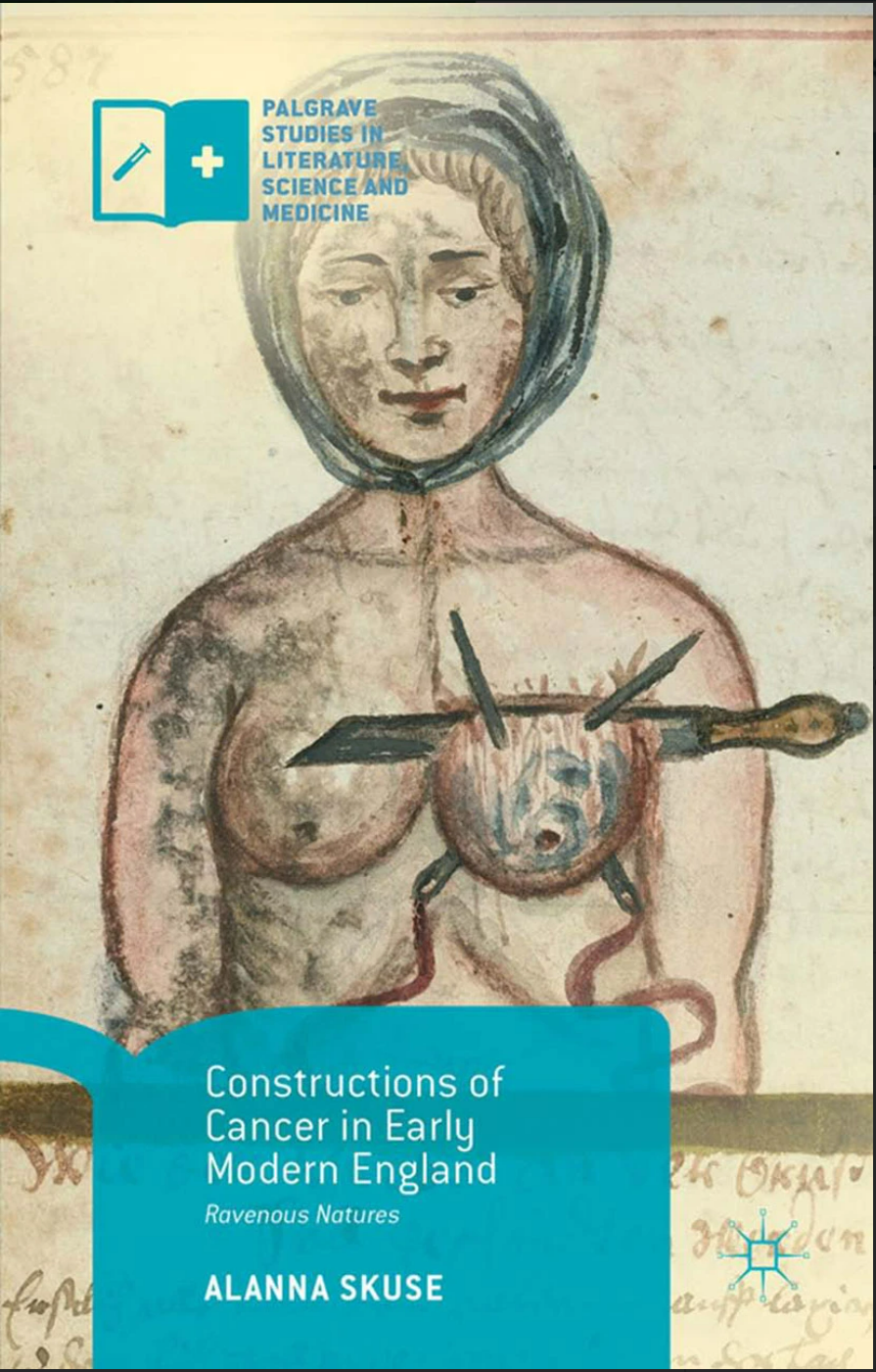 Cancer, Early Modernity, Early Modern Cancer, England, Early Modern Medical Thought, Arsenic, Breast Cancer, Canker, Humorism, Medicine, Uterus
