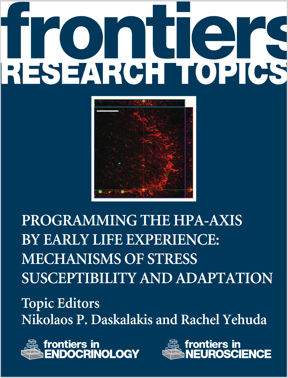 Body Composition, Thermogenesis, Brown Adipose Tissue, Body Size, Energy Expenditure, Indirect Calorimetry, Physical Activity, Metabolic Phenotyping