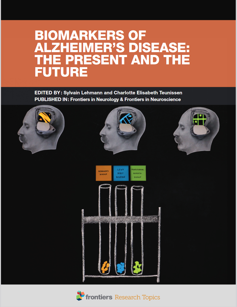 Validation, Neurochemistry, Dementias, Biomarkers, Methods, Discovery, Csf, Diagnosis, Alzheimer, Blood